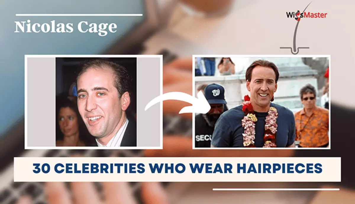 30+ Male Celebrities Who Wear Hairpieces